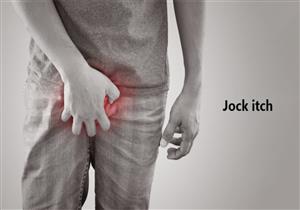  7 عوامل تعرضك للإصابة بحكة اللعب.. إليك أعراضها وطرق علاجها