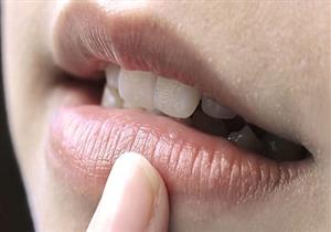 عادات تسبب اسمرار الشفاه.. تجنبيها