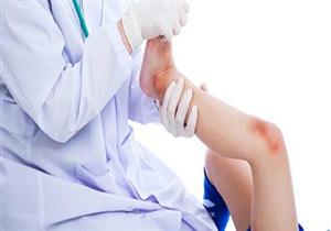 ابنك اتأخر في المشي.. اعرفي السبب؟