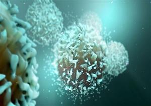  الاضطراب الوراثي الذي يؤدي إلى تكرار خلع الكتف