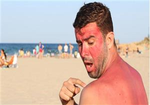 منها حروق الشمس.. أشياء تهدد صحة مرضى السكري في الصيف