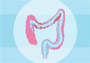 ودّع الإمساك.. إليك أفضل 5 طرق لتنظيف القولون من السموم