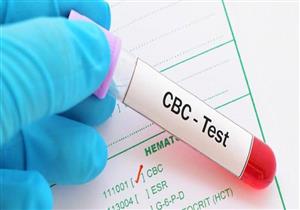 هل تؤكد صورة الدم الكاملة الإصابة بكورونا من عدمها؟.. طبيب يوضح