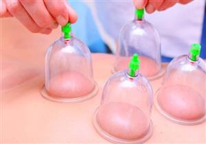 بعد خضوع بنزيما لها.. تعرف على فوائد "العلاج بالحجامة"