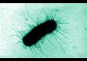 جرثومة "شيجيلا" تتسبب في حالات تسمم في الأردن