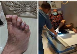 سقوط ديكور تصوير على محسن منصور في كواليس العمل