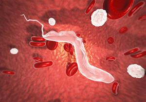 حسام موافي يكشف عن سبب جرثومة المعدة.. ويحذر من أكل الشارع