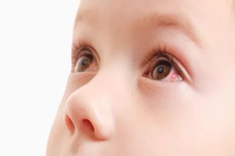 في السنة الأولى- فحوصات لعين الطفل لا غنى عنها 