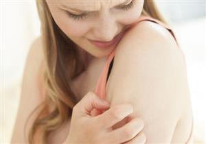 حكة الجسم المفاجئة.. هل تستدعي زيارة الطبيب؟