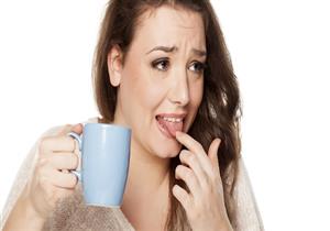  أول شيء يجب فعله حال "حرق فمك" بعد تناول الطعام الساخن