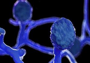 فيروس كورونا: ظهور أول إصابة بالفطر الأسود في درعا 