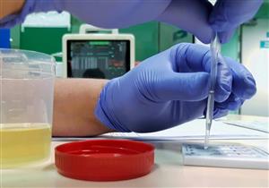 تحليل المخدرات في البول.. ما مدى دقة نتائجه؟