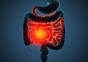 استشر طبيبك قبل استخدامها.. 6 طرق طبيعية لعلاج مرض كرون