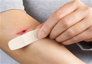 ما الطريقة الصحيحة لالتئام الجروح؟