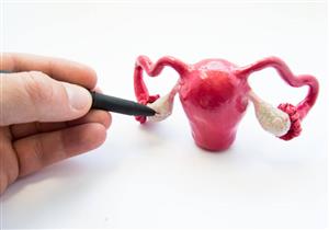 من أعراضه الغثيان ويهدد بمضاعفات خطيرة.. إليك أبرز أسباب التواء المبيض