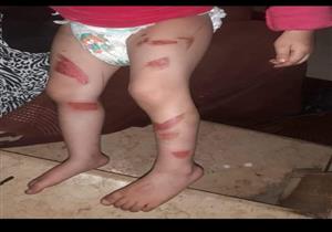 حبس رجل وزوجته عذبا طفلة الأول بالفيوم