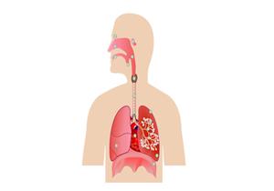 إلى جانب الرئتين.. أجزاء أخرى من الجسم قد يؤثر عليها كورونا في الموجة الجديدة