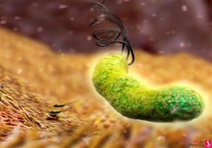 هل جرثومة المعدة تسبب السرطان؟