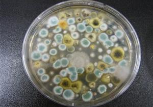  الفرق بين الفطر الأسود والأبيض والأصفر.. أيهم أكثر خطورة؟