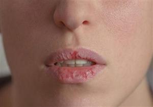 أبرزها العرقسوس.. 4 مشروبات تحافظ على ترطيب الفم أثناء الصيام