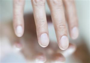 لقاح الألمان يبتكرون طريقة لكشف السرطان من حالة الأظافر