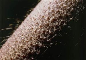 هل الشعور بقشعريرة مفاجئة علامة على مرض معين؟