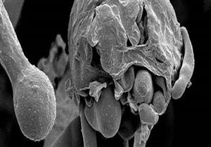 أبرزها مصابة بـ"الفطر الأسود".. "الشكاوى الحكومية" تكشف عن تفاصيل استجابتها لعدد من استغاثات المواطنين