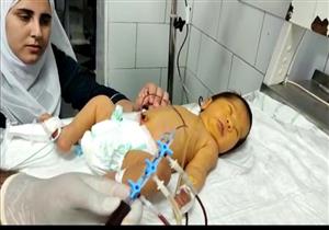 بالصور.. تغيير دم طفل مبتسر بمستشفى شربين في الدقهلية