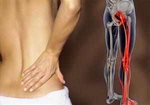 عوامل تزيد من فرص الإصابة بعرق النسا.. إليك طرق الوقاية