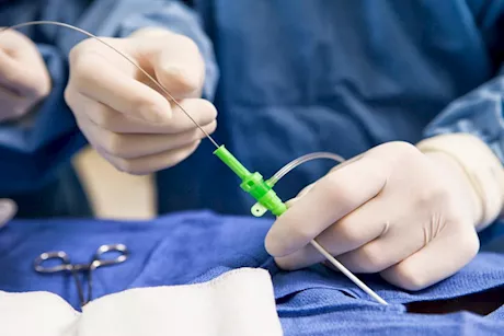 ما دور القسطرة في تشخيص أمراض الشرايين بدقة؟