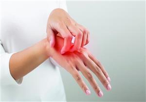 في الموجة الحارة.. إليك أسباب وأعراض وعلاج تسمم الشمس