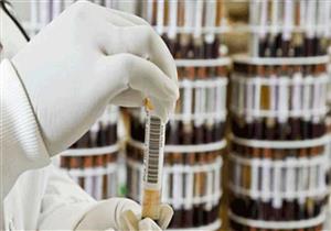 صندوق مكافحة وعلاج الإدمان: مخالطة المتعاطين عامل في إيجابية عينة التحليل