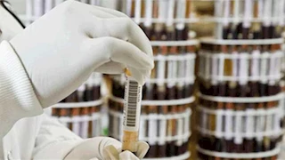 مدير مكافحة الإدمان يكشف حقيقة تحليل المخدرات العشوائي للمواطنين