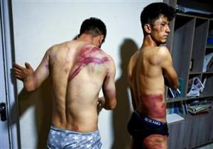 صحفيان أفغانيان يرويان تفاصيل تعرضهما للضرب من جانب طالبان بعد تغطية تظاهرات