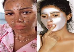 مكونات الماسكات الطبيعية للنجمات.. أبرزها الثوم والكركم