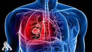 طبيب يكشف عن القاتل رقم واحد في العالم 