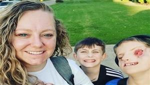 ولد بلا عينين.. امرأة تشارك قصة طفلها لهذا السبب