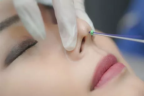علامات تشير إلى ضرورة تجميل الأنف.. تعرف عليها