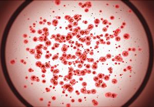 بعد وفاة فريد الديب- كيف يؤدي سرطان الدم للموت؟ "فيديوجرافيك"