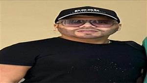 بعد جراحة التجميل كيف تغيرت ملامح عمر كمال؟