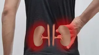 علامات مبكرة قد تكشف تراجع وظائف الكلى.. أبرزها تورم القدمين
