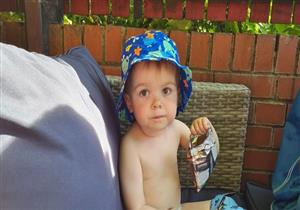 أول حالة في العالم – طفل يصاب بمرض نادر جدًا