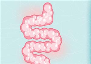 حسام موافي يحذر من غازات القولون: عرض لمرض خطير
