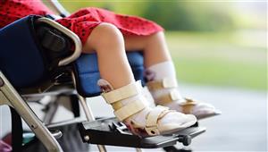 تستهدف 747 ألف حالة.. انطلاق حملة التطعيم ضد شلل الأطفال في الإسكندرية