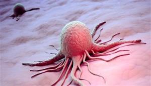 اكتشاف الخلايا المسؤولة عن انتكاس مرضى سرطان القولون بعد استئصال الأورام