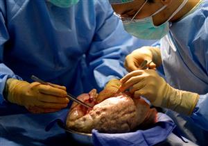 رفض حاد في آخر 48 ساعة.. كواليس وفاة "سحر" صاحبة أول عملية زراعة رئة في مصر