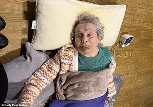 أنقِذت بعد 25 ساعة- تعرض سيدة تسعينية لكسر في الفخذ بعد سقوطها أرضًا