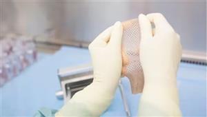 مشروع تكلفته 100 مليون يورو.. ابتكار جلد اصطناعي يعالج الحروق الشديدة 