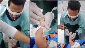 مراهنة على حياة طفل.. تحرك عاجل من الصحة بشأن "فيديو الكانيولا"