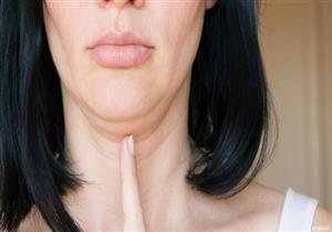   الذقن المزدوج.. أكثر من مجرد مشكلة جمالية